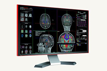 nordicBrainEx（临床fMRI数据后处理软件）
